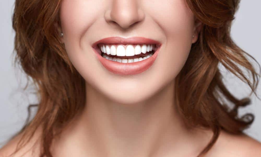 Make your TEETH PERFECT in 1 week with Dental Veneers