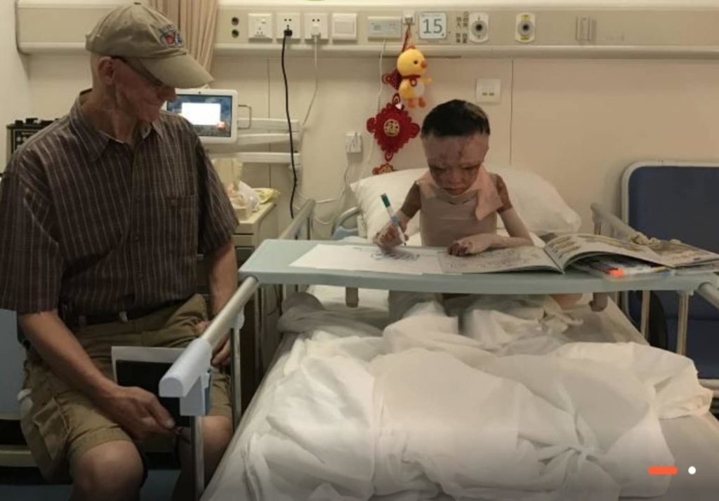 Fundraising Efforts Underway for Young Chinese Burn Victim