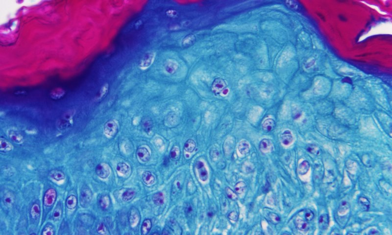 Chongqing Reports first Monkeypox Case in Chinese Mainland
